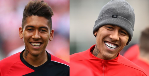 Diseño de Sonrisa Firmino